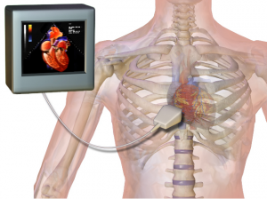 What is Echo test, why & how its done, what results mean: Explained by Dr Ravi Vishnu Prasad